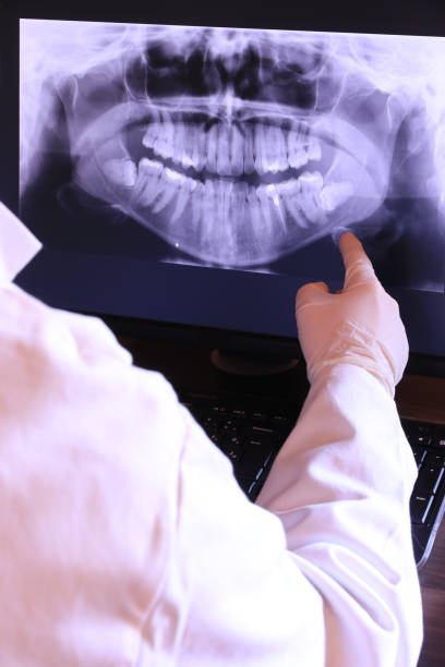 Best Emergency Dental Extractions in Millcreek, UT