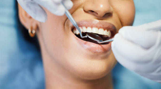 Best Emergency Dentist for Lost Fillings or Crowns in Millcreek, UT