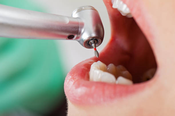 Best Mobile Emergency Dentist in Millcreek, UT